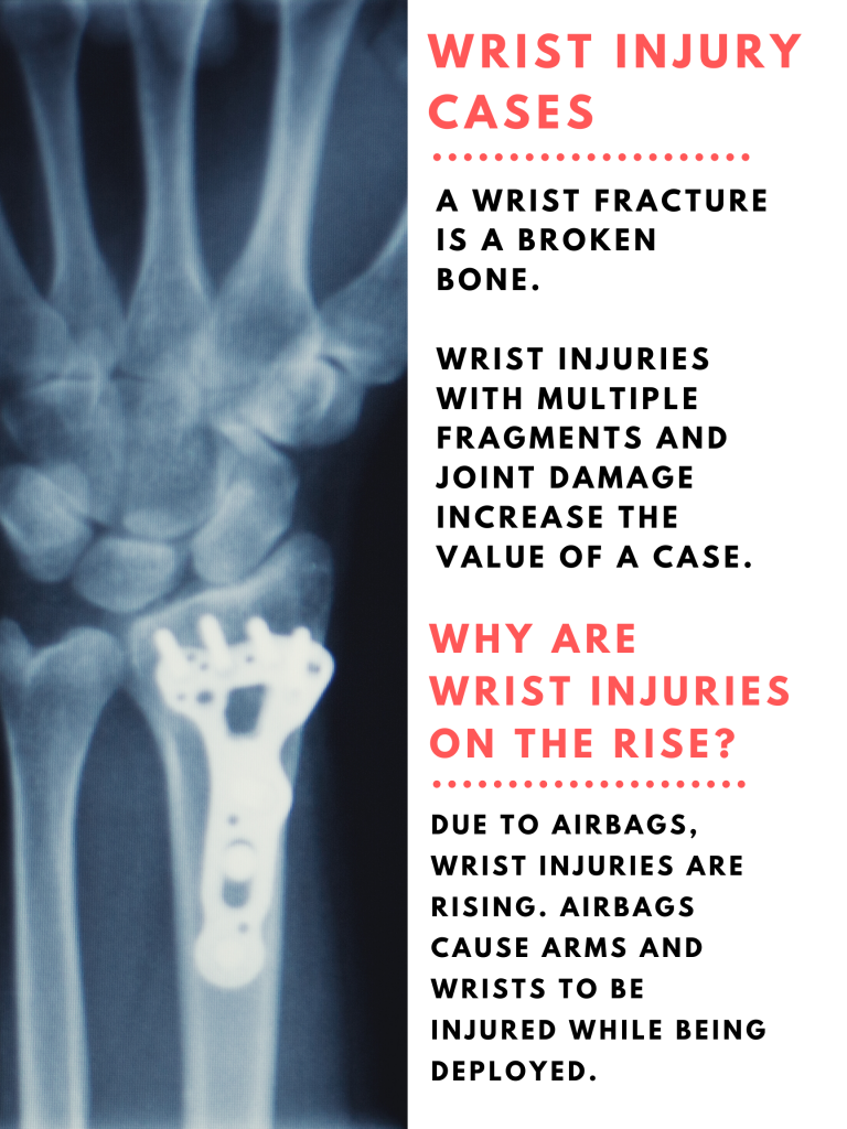 Wrist Injury Settlement Amounts Compensation Payouts