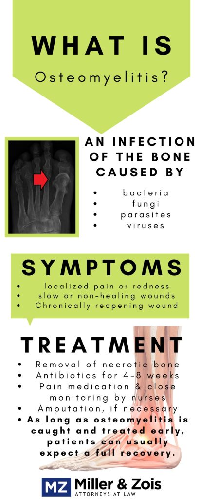 osteopmye-411x1024